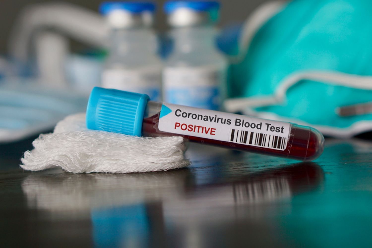 Coronavirus : 3 décès dans le Grand Est, dont une Mosellane